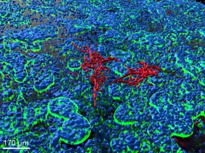 3D-Rekonstruktionen der Epithelzellschicht des Darms mit C. albicans (Fluoreszenzaufnahme) Organ-Modell erleichtert Verständnis von Pilzinfektionen