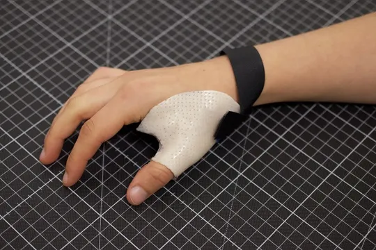 Ergotherapie stärkt Beweglichkeit von Hand und Fingern