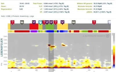 Fig. 1 Heart rate variability measurement during a Subtle Body Balance treatment A Key to Deep Regeneration - Strengthening the Autonomic Nervous System Through Subtle Body Balance by the Goethert Method