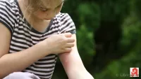 Wenn&rsquo;s sticht, brennt oder beißt: Die richtige Hilfe zur richtigen Zeit