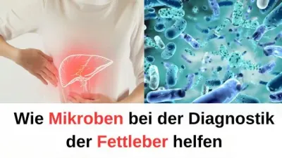 Wie Mikroben bei der Diagnostik der Fettleber helfen / Redaktion bioresonanz-zukunft.de Wie Mikroben bei der Diagnostik der Fettleber helfen