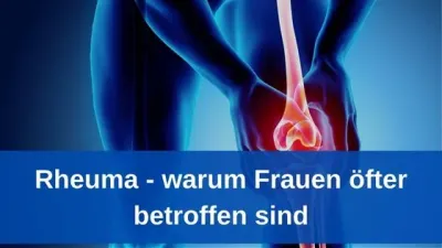 Rheuma - warum Frauen öfter betroffen sind