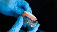 Zahnersatz - Prothese Gibt es Alternativen zu Implantaten mit denen sich ein Zahnimplantat vermeiden lässt?